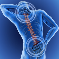 Collection image for: Tutori per Tronco