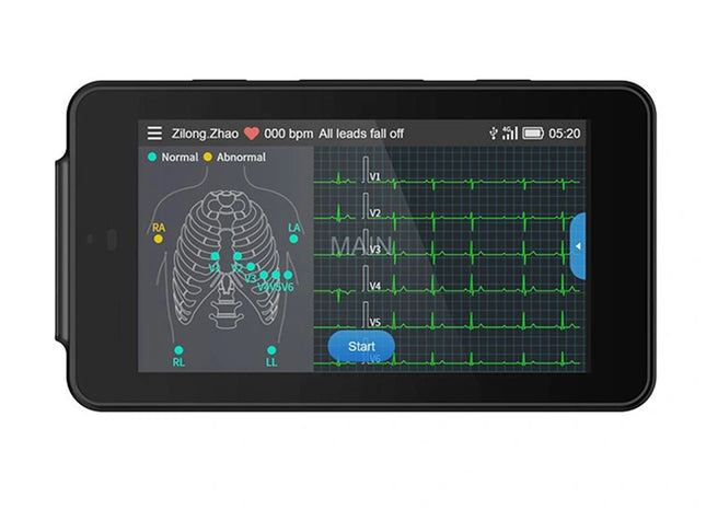 Elettrocardiografo Portatile 6/12 Derivazioni – GIMA PCECG-50