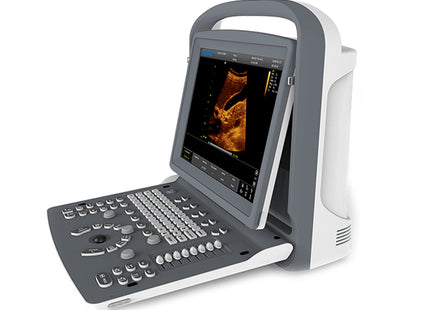 Ecografo Portatile Chison ECO2 Bianco e Nero – 1 Connettore Sonda