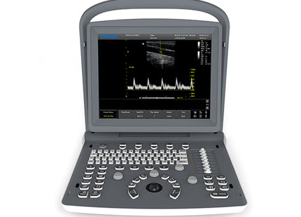 Ecografo Portatile Chison ECO2 Bianco e Nero – 1 Connettore Sonda