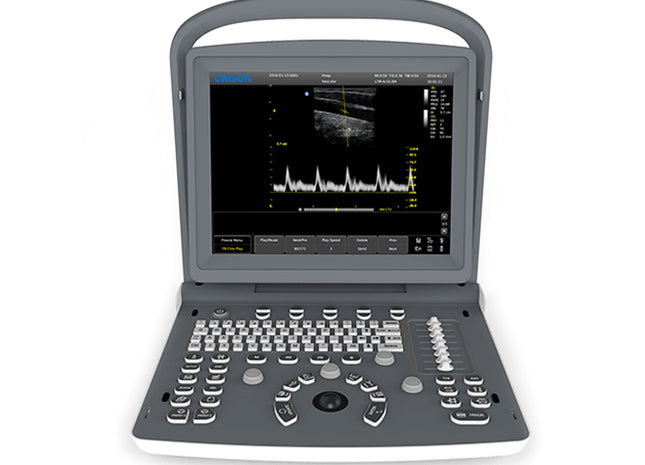 Ecografo Portatile Chison ECO2 Bianco e Nero – 1 Connettore Sonda