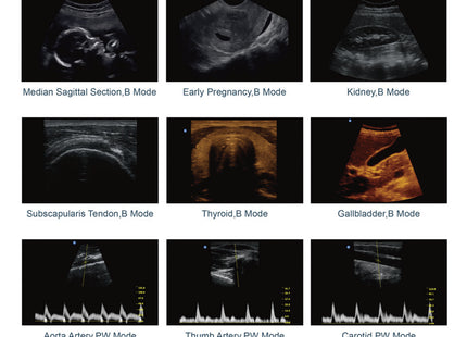 Ecografo Portatile Chison ECO2 Bianco e Nero – 1 Connettore Sonda