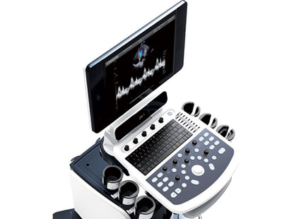 Ecografo Colordoppler Chison Qbit5 – LED 15” con Carrello Ecocolordoppler Professionale Gima con Hard Disk 32GB e 2 Sonde