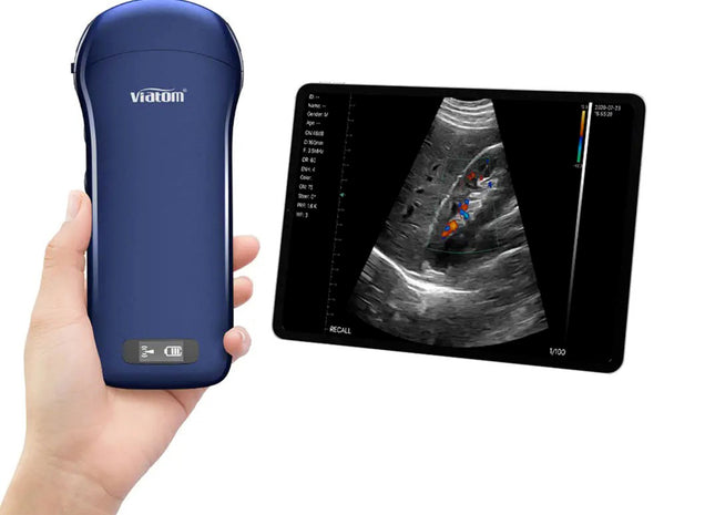 Ecografo Portatile Wireless 3in1 Viatom – Colordoppler Lineare, Convesso e Cardiaco, Compatibile con Tablet e Smartphone