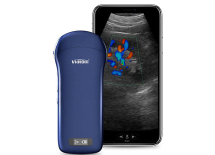 Ecografo Portatile Wireless 3in1 Viatom – Colordoppler Lineare, Convesso e Cardiaco, Compatibile con Tablet e Smartphone