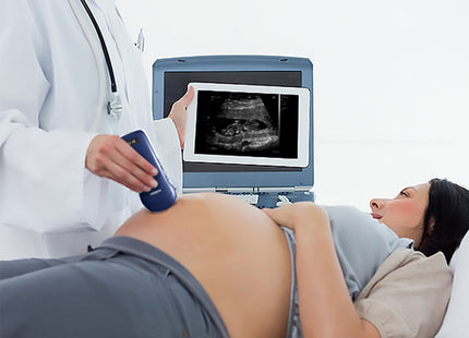 Ecografo Portatile Wireless 3in1 Viatom – Colordoppler Lineare, Convesso e Cardiaco, Compatibile con Tablet e Smartphone