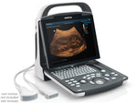Ecografo Professionale Portatile In B/N Gima Mod. Mindray Dp-20