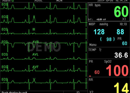 Monitor Multiparametrico PC-3000 – ECG, RESP, SpO₂, NIBP, 2-TEMP, PR