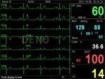 Monitor Multiparametrico Pc-3000 - Ecg, Resp, Spo2, Nibp, 2-Temp, Pr