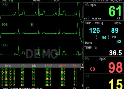 Monitor Multiparametrico PC-3000 – ECG, RESP, SpO₂, NIBP, 2-TEMP, PR