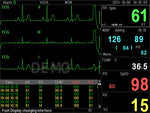 Monitor Multiparametrico Pc-3000 - Ecg, Resp, Spo2, Nibp, 2-Temp, Pr