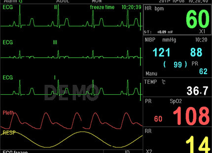 Monitor Multiparametrico PC-3000 – ECG, RESP, SpO₂, NIBP, 2-TEMP, PR
