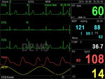 Monitor Multiparametrico Pc-3000 - Ecg, Resp, Spo2, Nibp, 2-Temp, Pr