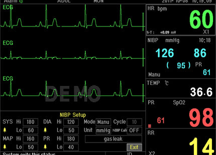 Monitor Multiparametrico PC-3000 – ECG, RESP, SpO₂, NIBP, 2-TEMP, PR