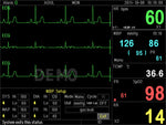 Monitor Multiparametrico Pc-3000 - Ecg, Resp, Spo2, Nibp, 2-Temp, Pr