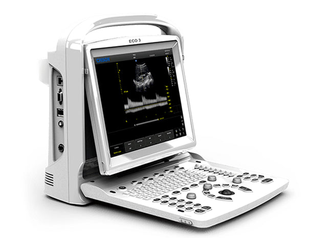 Ecografo Chison ECO3EXP bianco e nero con 2 ingressi sonda e Doppler PW. Portatile, leggero e potente. Display LED 12”, batteria 2,5h, qualità Gima.