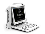 Ecografo Chison ECO3EXP bianco e nero con 2 ingressi sonda e Doppler PW. Portatile, leggero e potente. Display LED 12”, batteria 2,5h, qualità Gima.