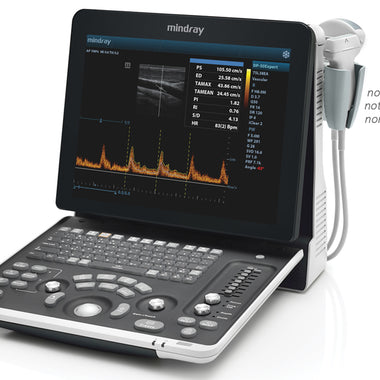 Ecografo Mindray DP-50 Expert bianco e nero, 15”, 500GB, 2 sonde. PW Doppler, 3D/4D, batteria ricaricabile e tecnologie Mindray iBeam, iClear, iScape.
