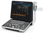 Ecografo Mindray DP-50 Expert bianco e nero, 15”, 500GB, 2 sonde. PW Doppler, 3D/4D, batteria ricaricabile e tecnologie Mindray iBeam, iClear, iScape.